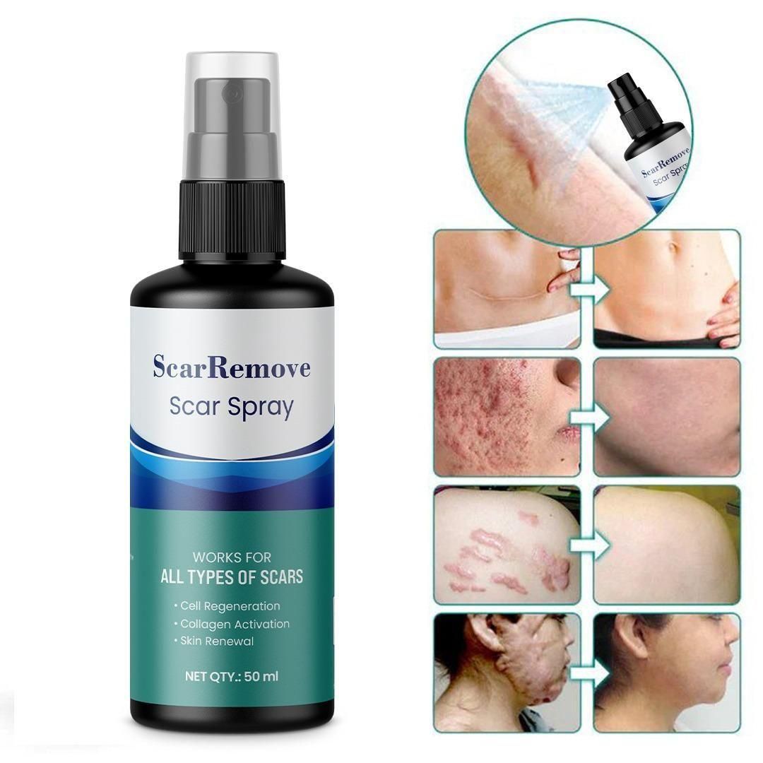 Scar Removal Spray 50ml Pack Of 2