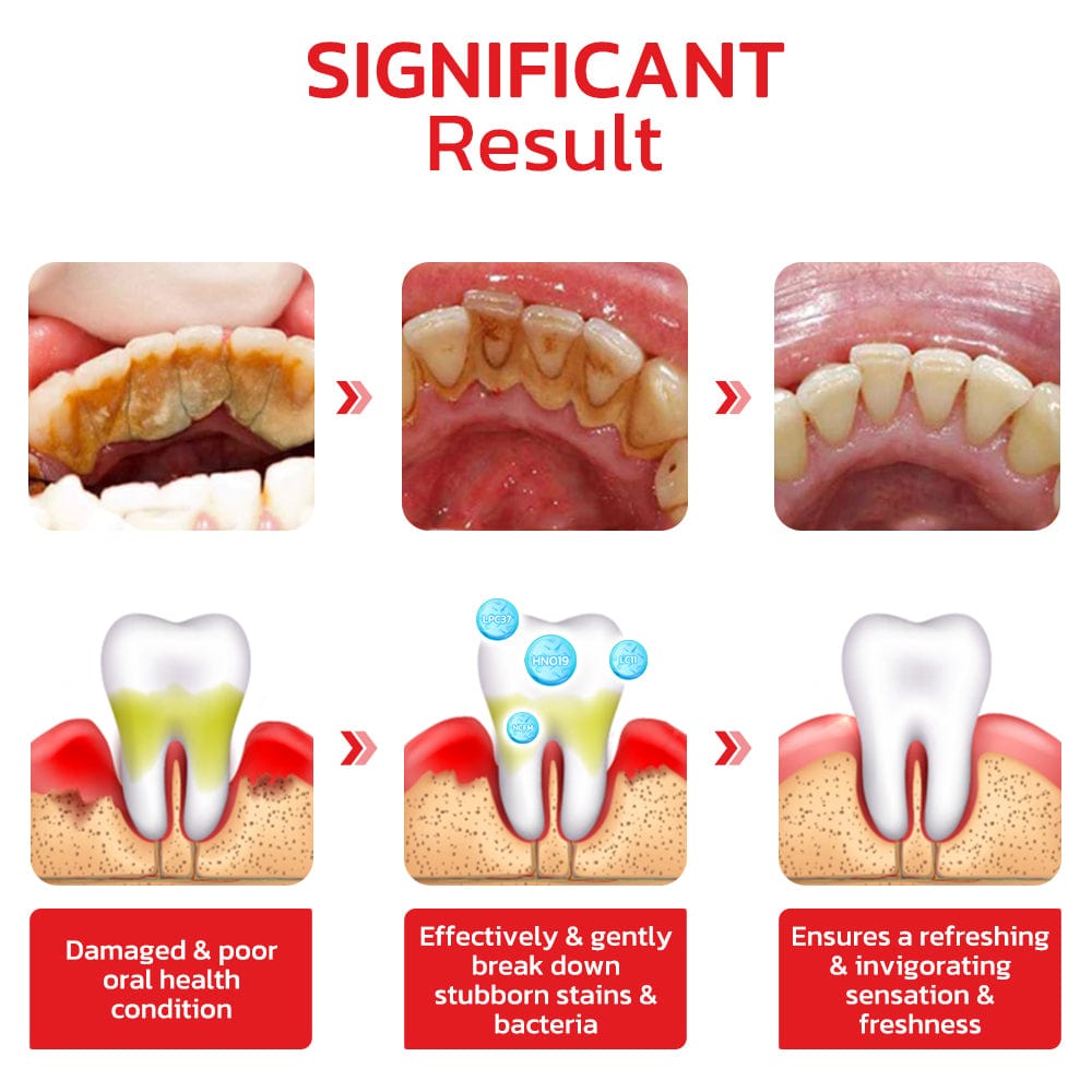 🌟SP-4 Probiotic Intensive Teeth 🦷✨ Whitening Toothpaste 😁 🤩💥SALE FLAT 50% OFF💥🤩