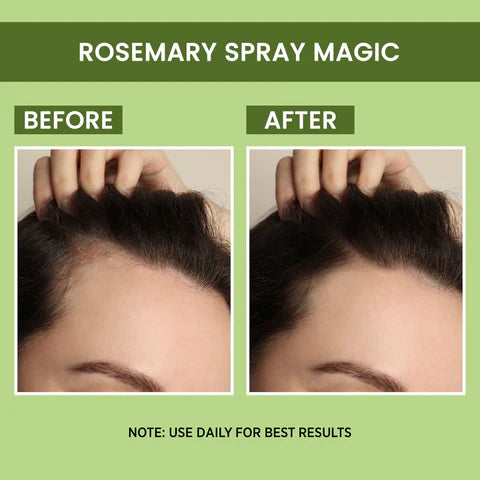 Rosemary Water Hair Spray For Regrowth (Buy 1 Get 1 Free)🔥