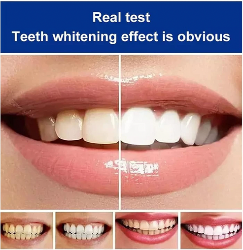 🌟SP-4 Probiotic Intensive Teeth 🦷✨ Whitening Toothpaste 😁 🤩💥SALE FLAT 50% OFF💥🤩