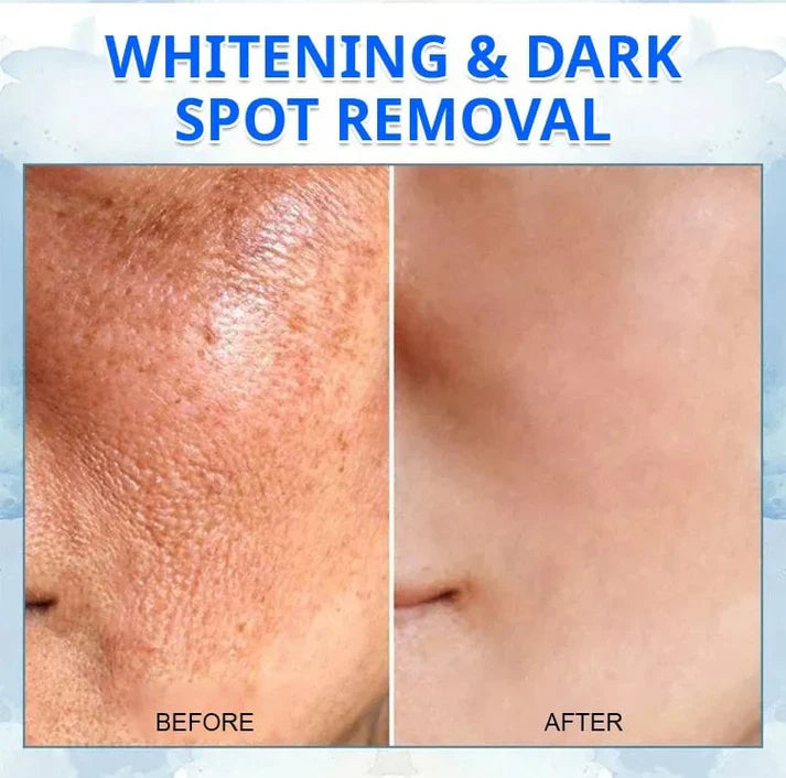 Advanced Firming & Wrinkle-Reducing Cream (Restore Skin Elasticity)